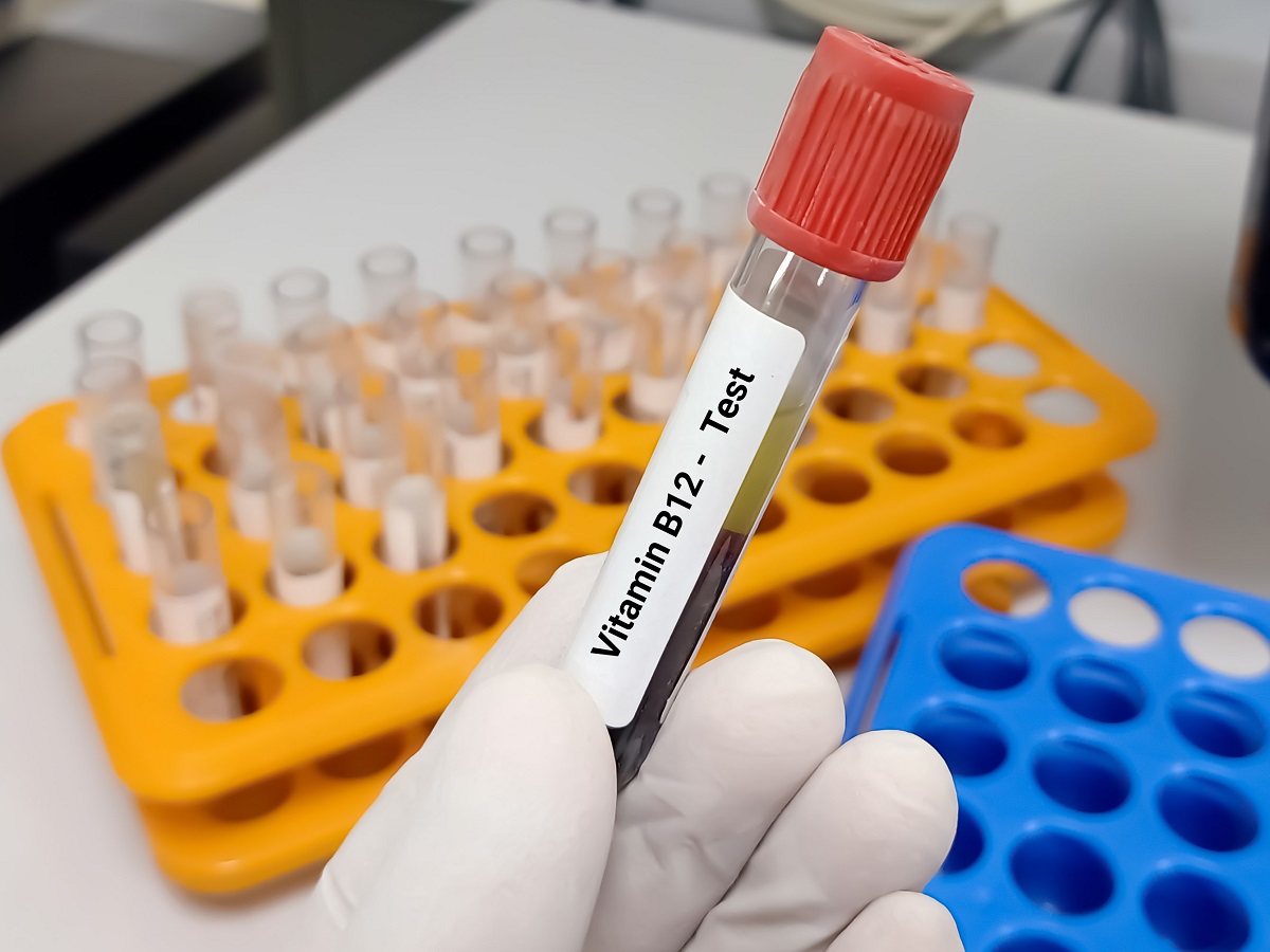 vitamina b12 alta sintomi e cura